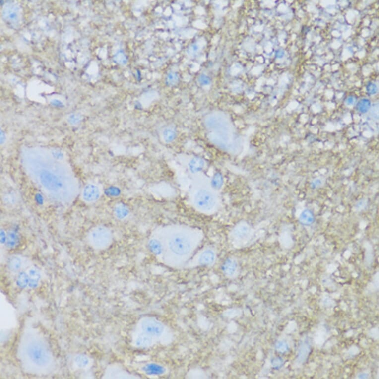 Immunohistochemistry - Anti-ATP1B2 Antibody (A92547) - Antibodies.com