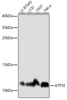 Immunohistochemistry of paraffin-embedded human liver using Anti-ATP5I Antibody (A16769) at dilution of 1:100 (40x lens).