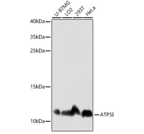 Western Blot - Anti-ATP5I Antibody (A92548) - Antibodies.com
