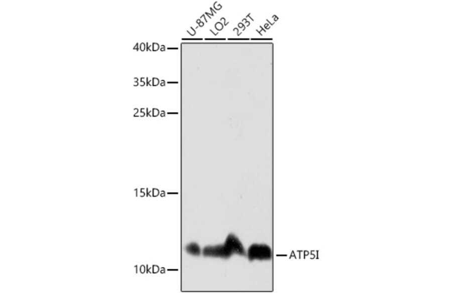 Western Blot - Anti-ATP5I Antibody (A92548) - Antibodies.com