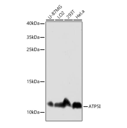 Western Blot - Anti-ATP5I Antibody (A92548) - Antibodies.com