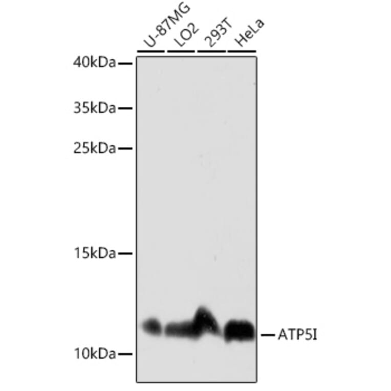 Western Blot - Anti-ATP5I Antibody (A92548) - Antibodies.com