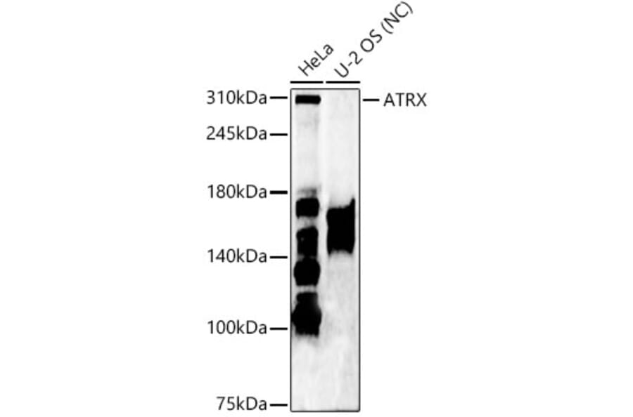 Western Blot - Anti-ATRX Antibody (A92549) - Antibodies.com