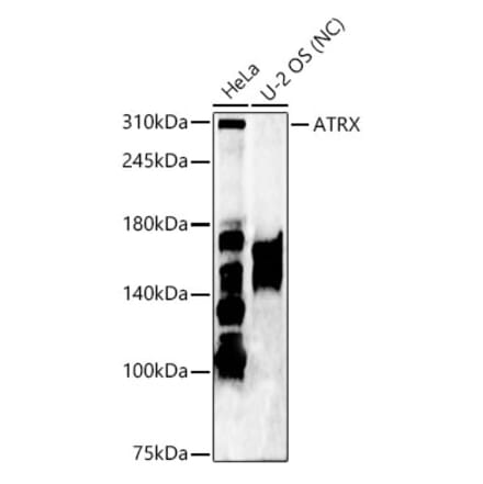 Western Blot - Anti-ATRX Antibody (A92549) - Antibodies.com