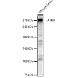 Western Blot - Anti-ATRX Antibody (A92549) - Antibodies.com