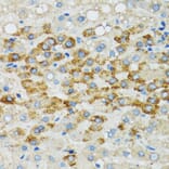Immunohistochemistry - Anti-Bim Antibody (A92550) - Antibodies.com