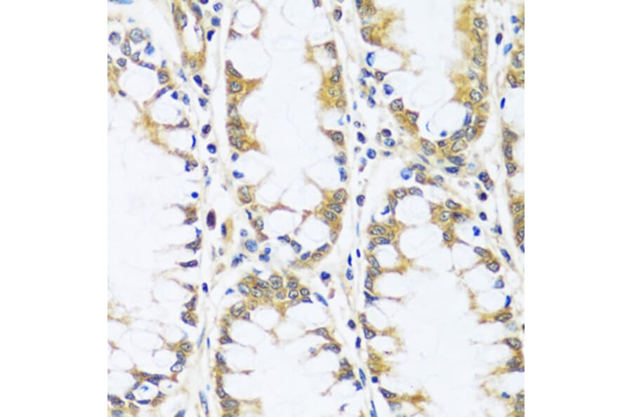 Immunohistochemistry - Anti-BLOC1S3 Antibody (A92551) - Antibodies.com