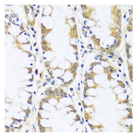 Immunohistochemistry - Anti-BLOC1S3 Antibody (A92551) - Antibodies.com