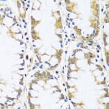 Immunohistochemistry - Anti-BLOC1S3 Antibody (A92551) - Antibodies.com