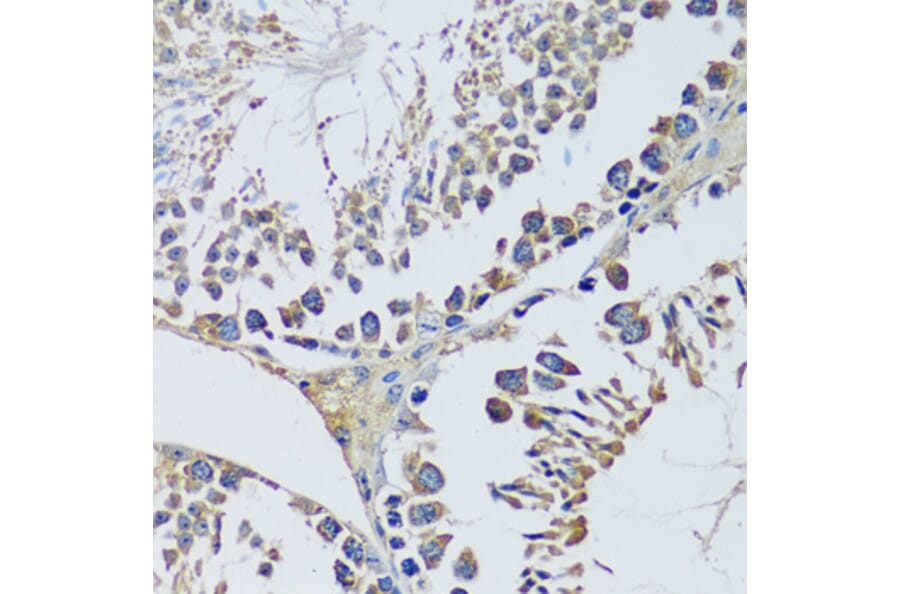 Immunohistochemistry - Anti-BLOC1S3 Antibody (A92551) - Antibodies.com