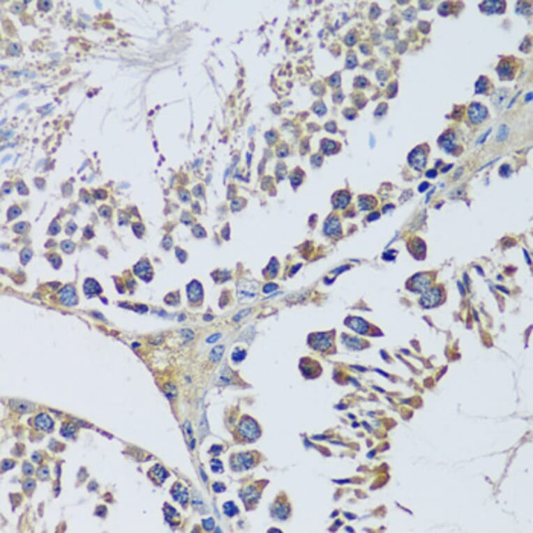 Immunohistochemistry - Anti-BLOC1S3 Antibody (A92551) - Antibodies.com