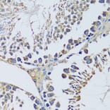 Immunohistochemistry - Anti-BLOC1S3 Antibody (A92551) - Antibodies.com