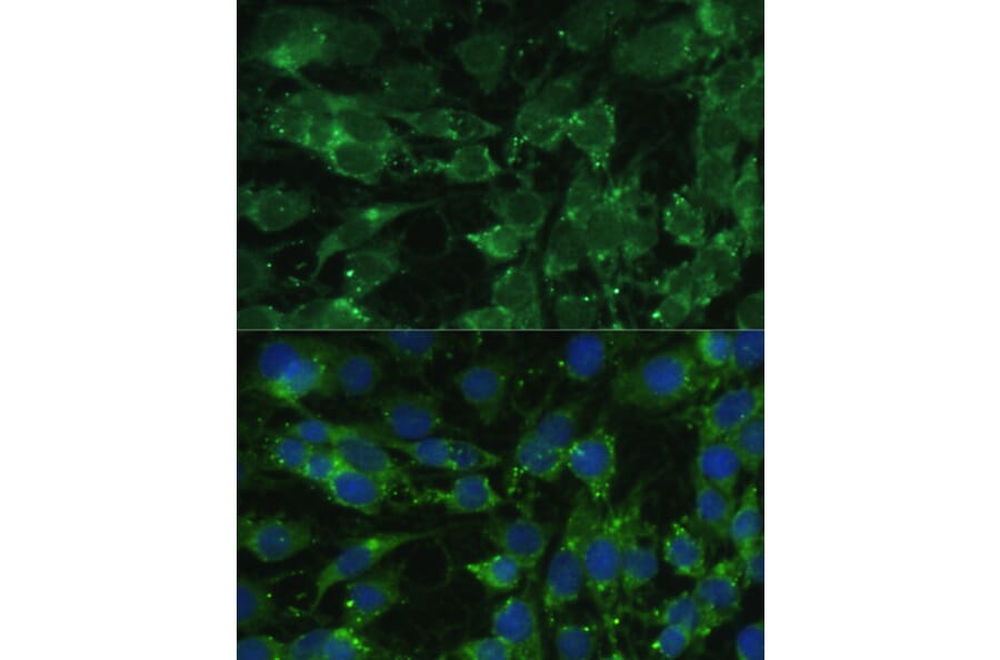 Immunofluorescence - Anti-BLOC1S3 Antibody (A92551) - Antibodies.com
