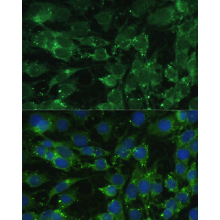 Immunofluorescence - Anti-BLOC1S3 Antibody (A92551) - Antibodies.com