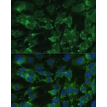 Immunofluorescence - Anti-BLOC1S3 Antibody (A92551) - Antibodies.com