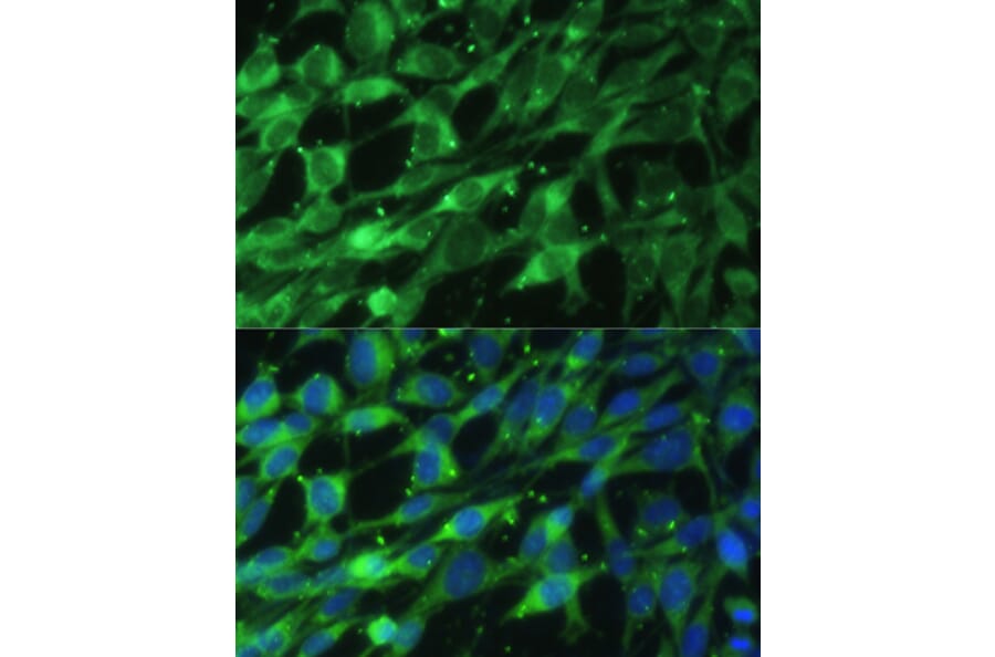 Immunofluorescence - Anti-BLOC1S3 Antibody (A92551) - Antibodies.com
