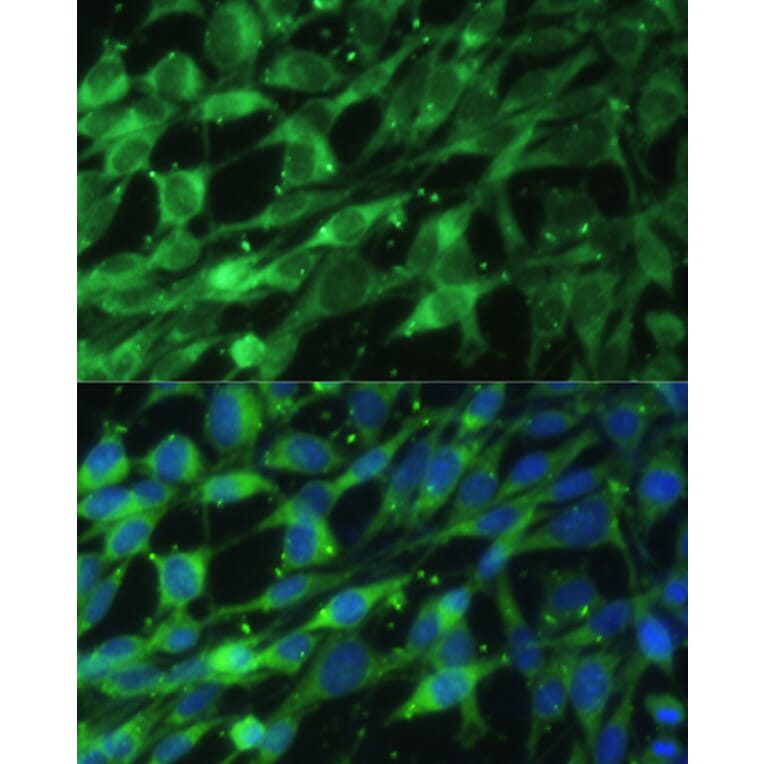 Immunofluorescence - Anti-BLOC1S3 Antibody (A92551) - Antibodies.com