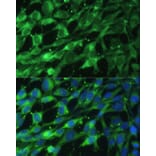 Immunofluorescence - Anti-BLOC1S3 Antibody (A92551) - Antibodies.com