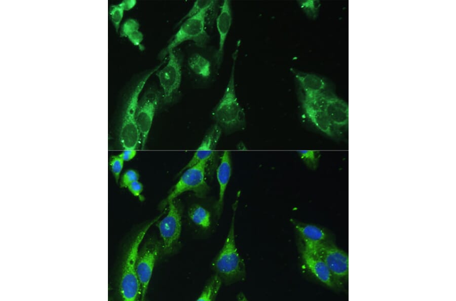 Immunofluorescence - Anti-BLOC1S3 Antibody (A92551) - Antibodies.com