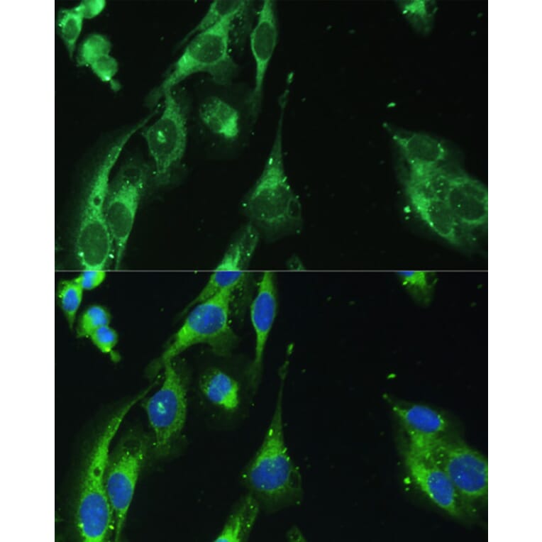 Immunofluorescence - Anti-BLOC1S3 Antibody (A92551) - Antibodies.com