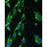 Immunofluorescence - Anti-BLOC1S3 Antibody (A92551) - Antibodies.com