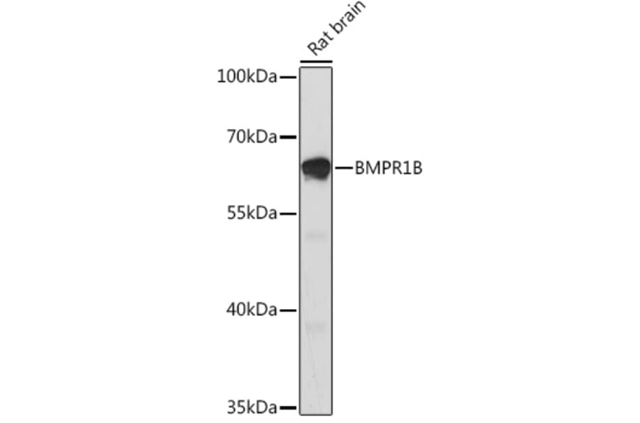 Western Blot - Anti-BMPR1B Antibody (A92552) - Antibodies.com