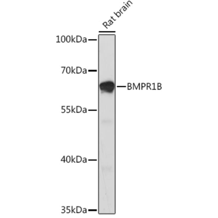 Western Blot - Anti-BMPR1B Antibody (A92552) - Antibodies.com