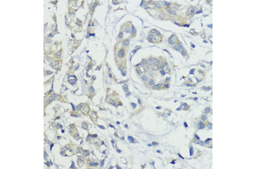 Immunohistochemistry - Anti-BMPR1B Antibody (A92552) - Antibodies.com