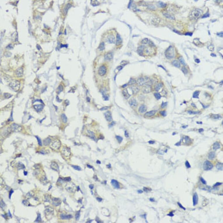 Immunohistochemistry - Anti-BMPR1B Antibody (A92552) - Antibodies.com