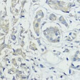 Immunohistochemistry - Anti-BMPR1B Antibody (A92552) - Antibodies.com