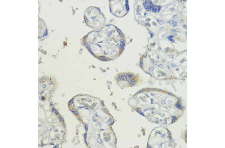 Immunohistochemistry - Anti-BMPR1B Antibody (A92552) - Antibodies.com