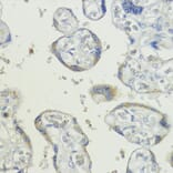 Immunohistochemistry - Anti-BMPR1B Antibody (A92552) - Antibodies.com