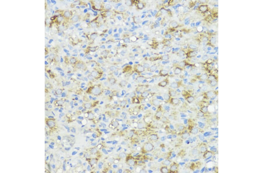 Immunohistochemistry - Anti-BMPR1B Antibody (A92552) - Antibodies.com
