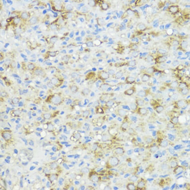 Immunohistochemistry - Anti-BMPR1B Antibody (A92552) - Antibodies.com