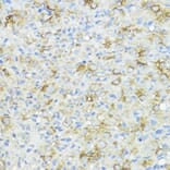 Immunohistochemistry - Anti-BMPR1B Antibody (A92552) - Antibodies.com
