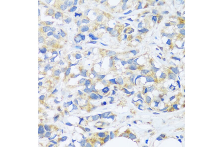 Immunohistochemistry - Anti-C3orf10 Antibody (A92553) - Antibodies.com