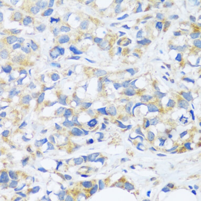 Immunohistochemistry - Anti-C3orf10 Antibody (A92553) - Antibodies.com