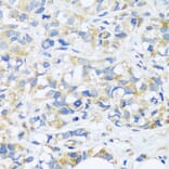 Immunohistochemistry - Anti-C3orf10 Antibody (A92553) - Antibodies.com