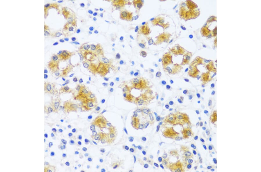 Immunohistochemistry - Anti-C3orf10 Antibody (A92553) - Antibodies.com