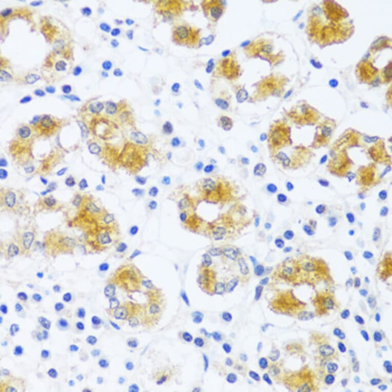 Immunohistochemistry - Anti-C3orf10 Antibody (A92553) - Antibodies.com
