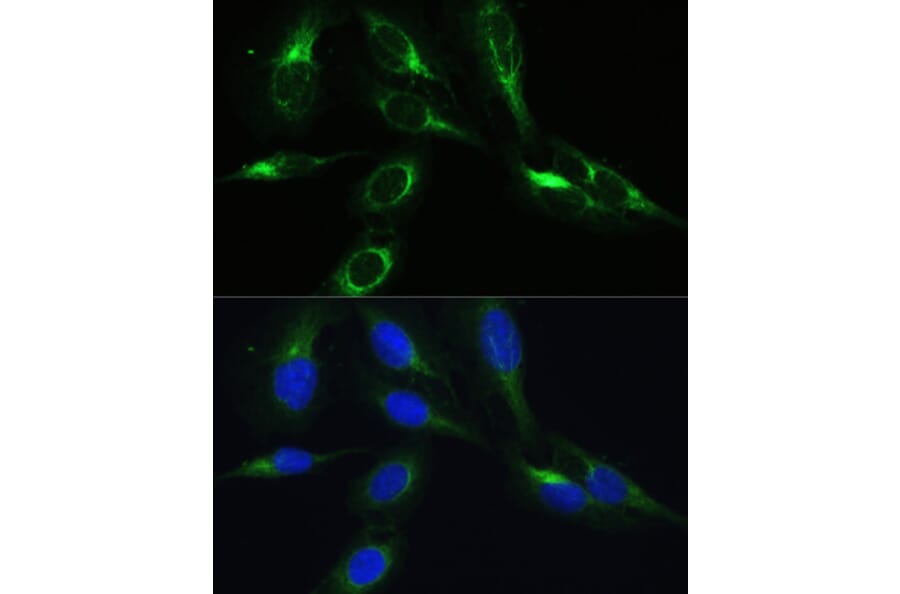 Immunofluorescence - Anti-C3orf10 Antibody (A92553) - Antibodies.com