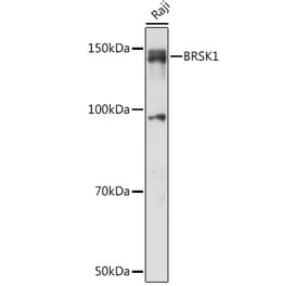 Western Blot - Anti-BRSK1 Antibody (A92554) - Antibodies.com