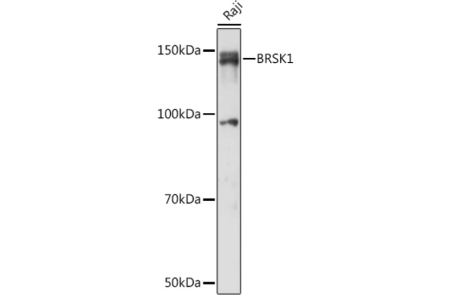 Western Blot - Anti-BRSK1 Antibody (A92554) - Antibodies.com