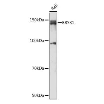 Western Blot - Anti-BRSK1 Antibody (A92554) - Antibodies.com