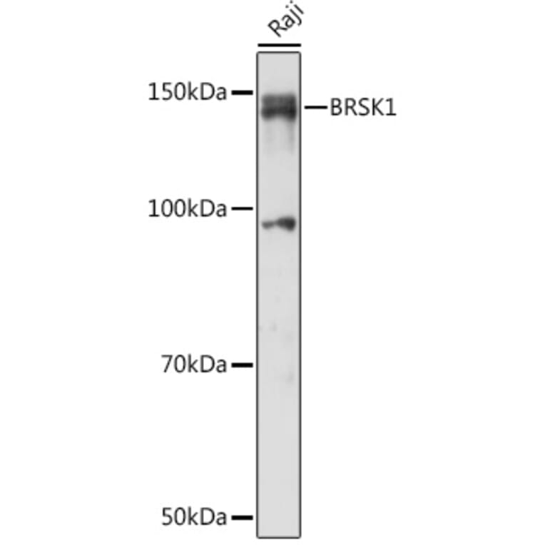 Western Blot - Anti-BRSK1 Antibody (A92554) - Antibodies.com