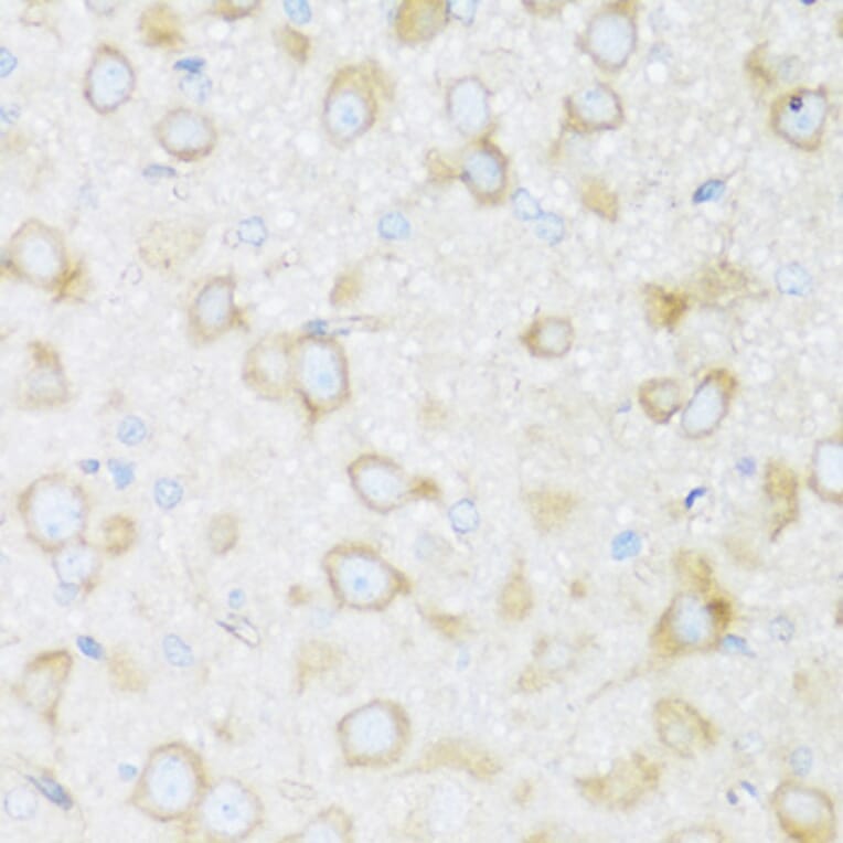 Immunohistochemistry - Anti-BRSK1 Antibody (A92554) - Antibodies.com