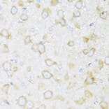 Immunohistochemistry - Anti-BRSK1 Antibody (A92554) - Antibodies.com