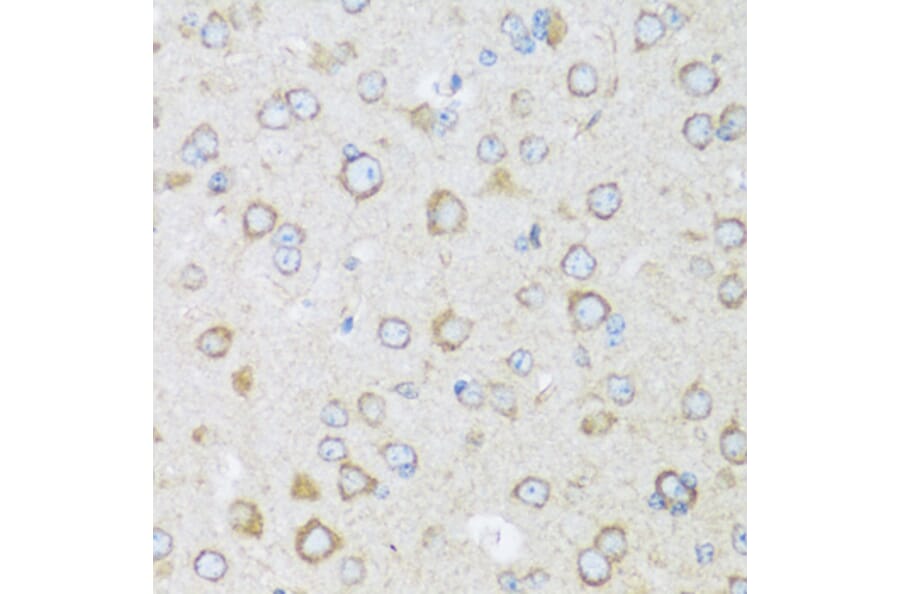 Immunohistochemistry - Anti-BRSK1 Antibody (A92554) - Antibodies.com