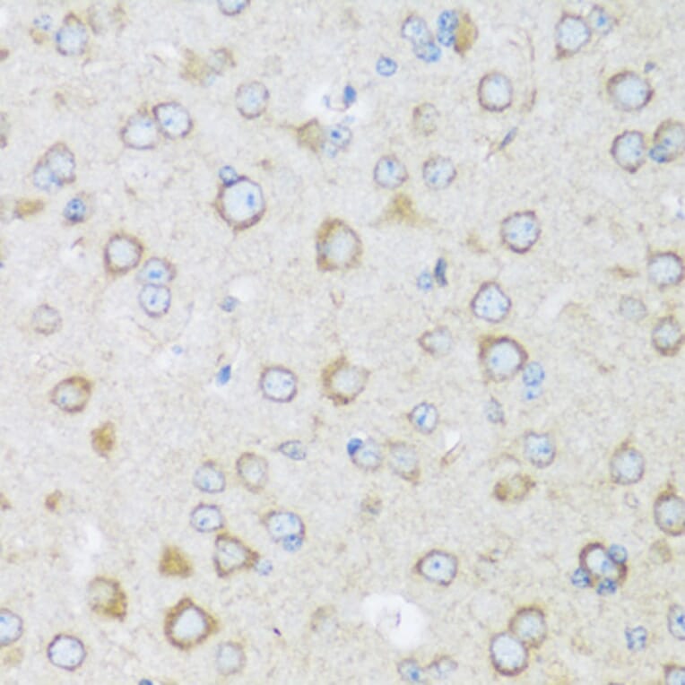 Immunohistochemistry - Anti-BRSK1 Antibody (A92554) - Antibodies.com