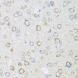 Immunohistochemistry - Anti-BRSK1 Antibody (A92554) - Antibodies.com